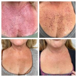 gg Certified CME LLC Launches Cosmetic Training Courses in Aesthetic Medicine